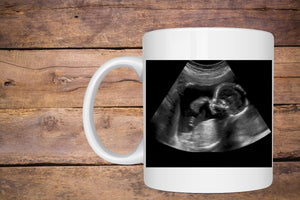 Custom Photo Mugs – Personalized Gift 11 oz Ceramic